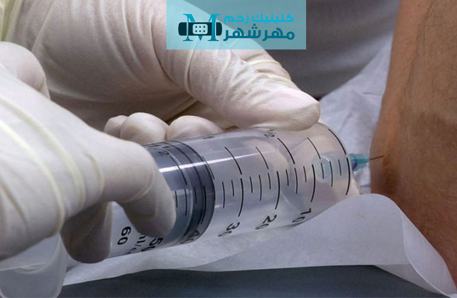 اوزون تراپی در درمان چه نوع بیماری هایی مورد استفاده قرار می گیرد؟