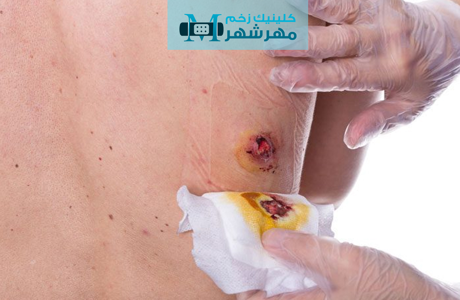آشنایی با فواید عسل