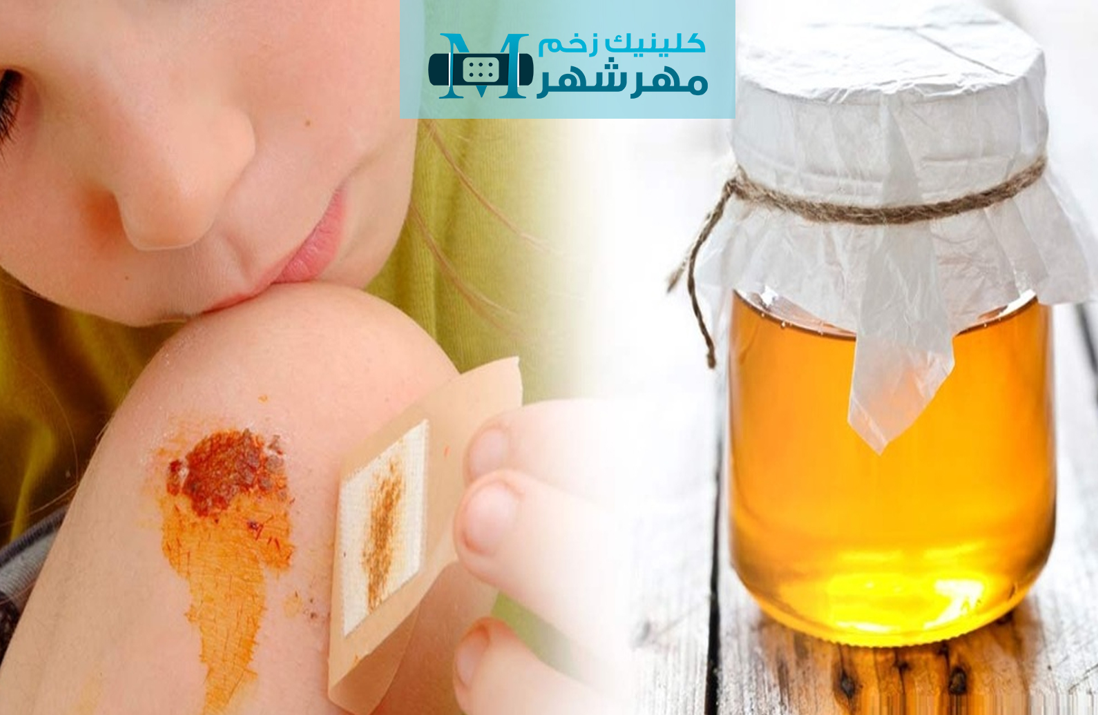 عدم اطلاع از عمق زخم و سوختگی