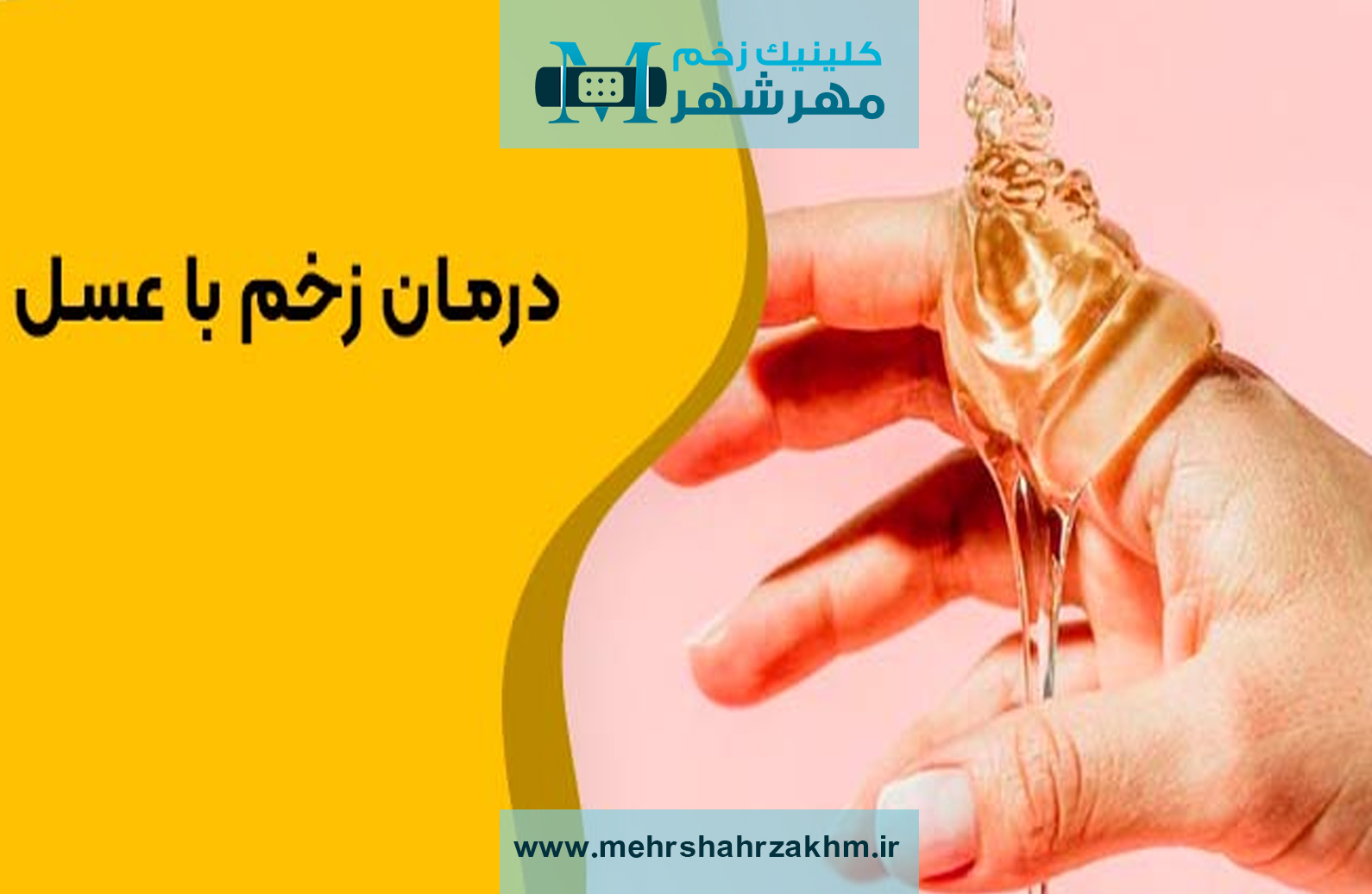  عسل در ترمیم زخم | کلینیک درمان زخم در کرج|درمان زخم دیابت در کرج | مهرشهر |نطرآباد|هشتگرد