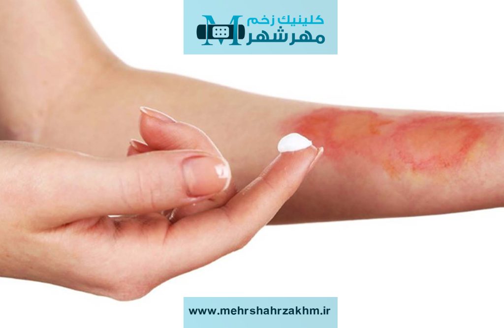 درمان زخم سوختگی در مهرشهر کرج|درمان سوختگی چیست؟|هشتگرد|نظرآباد