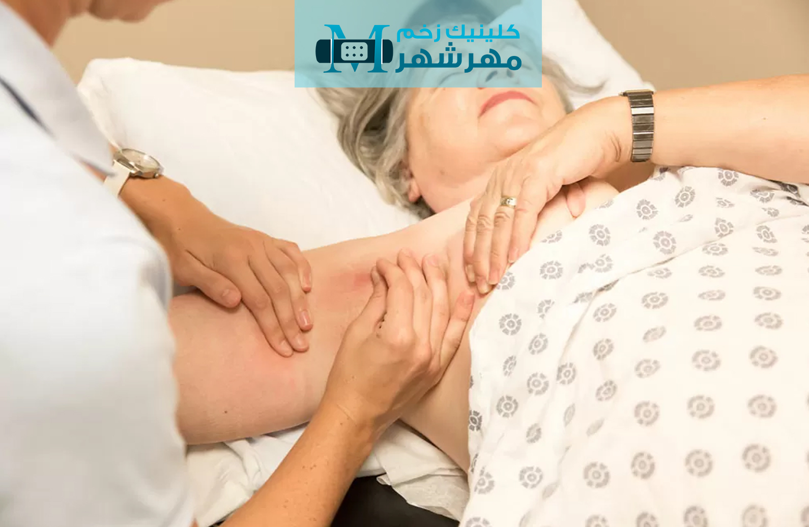 علائم و نشانه‌های لنف ادم