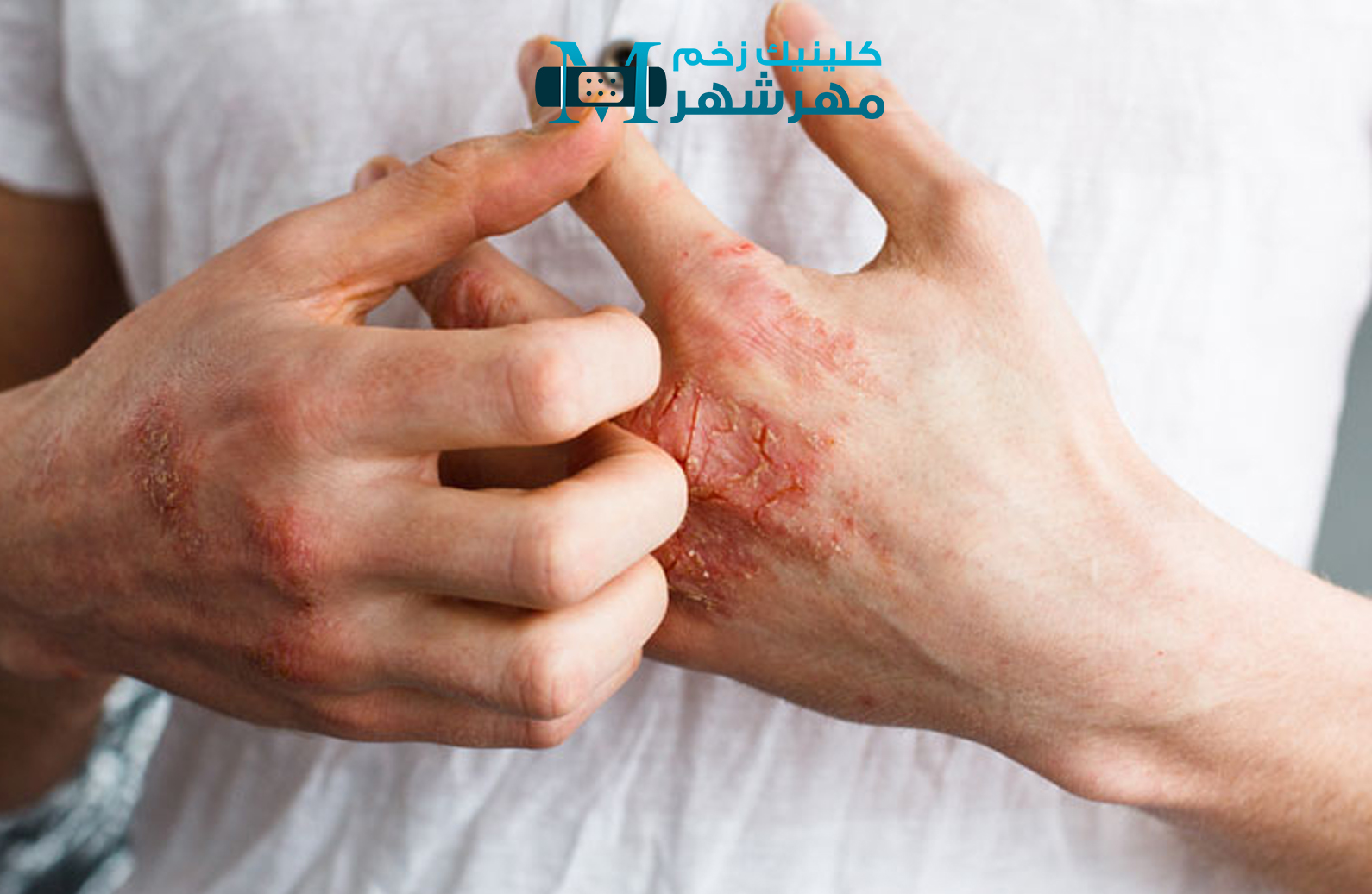 نشانه های عفونت زخم چیست؟