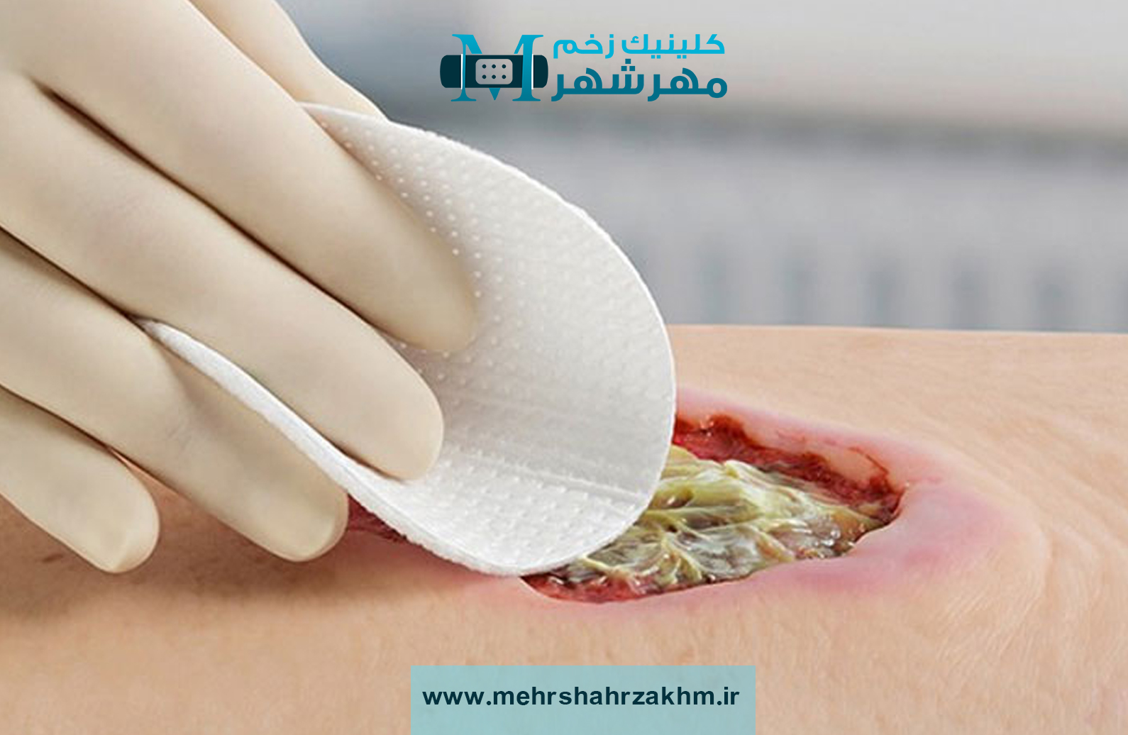 عفونت زخم|متخصص عفونت زخم در کرج|کلینیک عفونت زخم در کرج