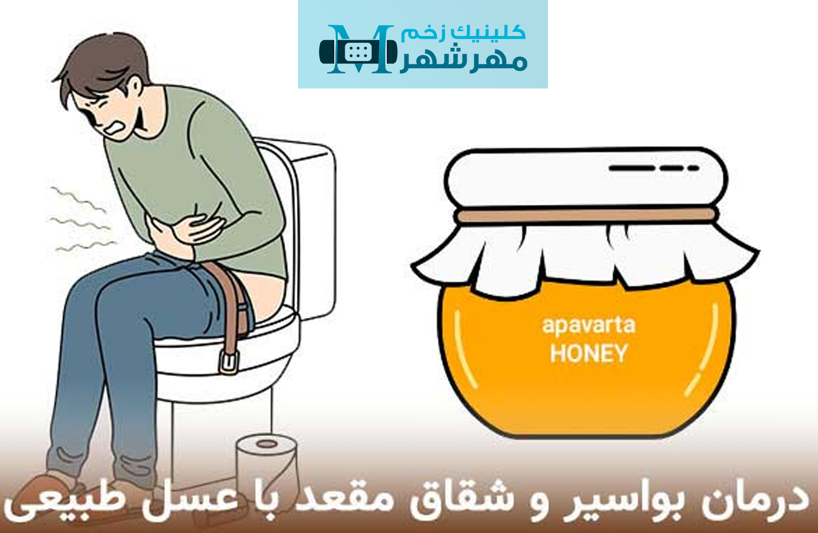 نحوه درمان شقاق با عسل