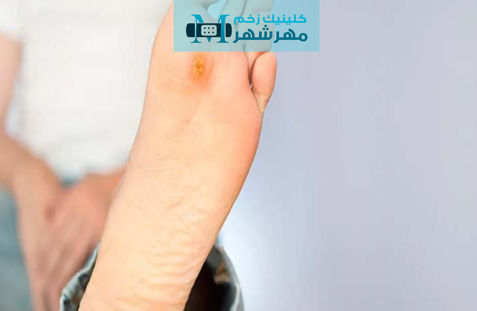 پیشگیری و درمان زخم‌ها