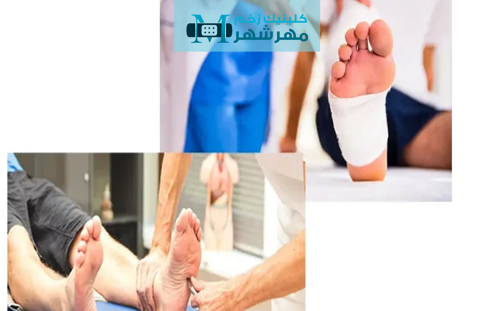 نتیجه‌ گیری در مورد زخم‌ های شریانی
