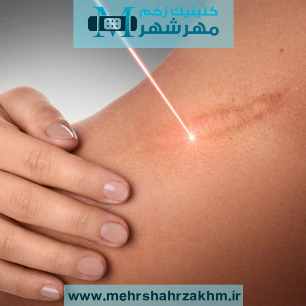 اسکار یا جای زخم چیست و چگونه درمان می‌شود؟