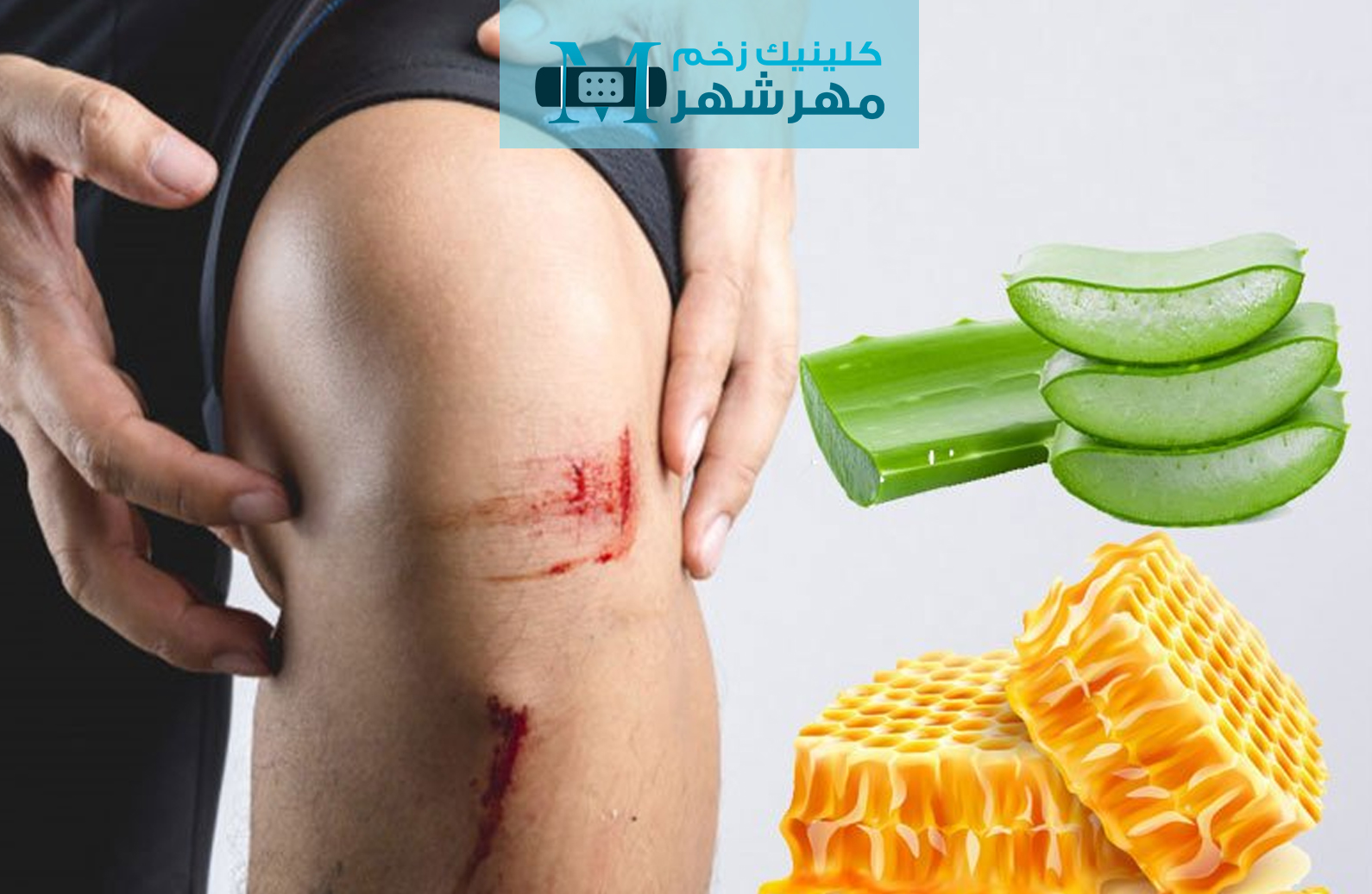 عوامل مؤثر بر بهبودی زخم چیست؟
