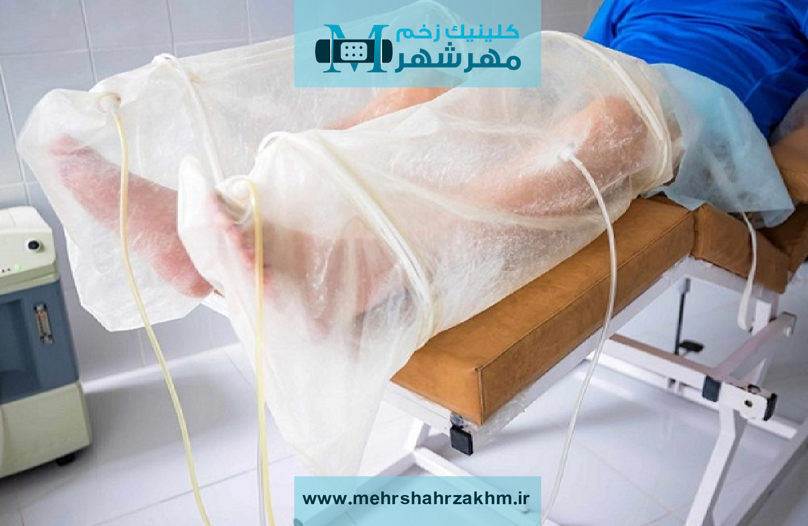 اوزون‌ تراپی و نقش آن در بازسازی سلولهای زخم