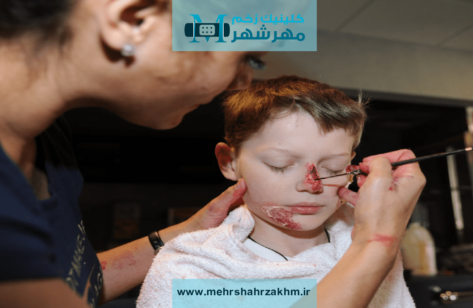 آشنایی با سیاه زخم و روش‌های پیشگیری از آن