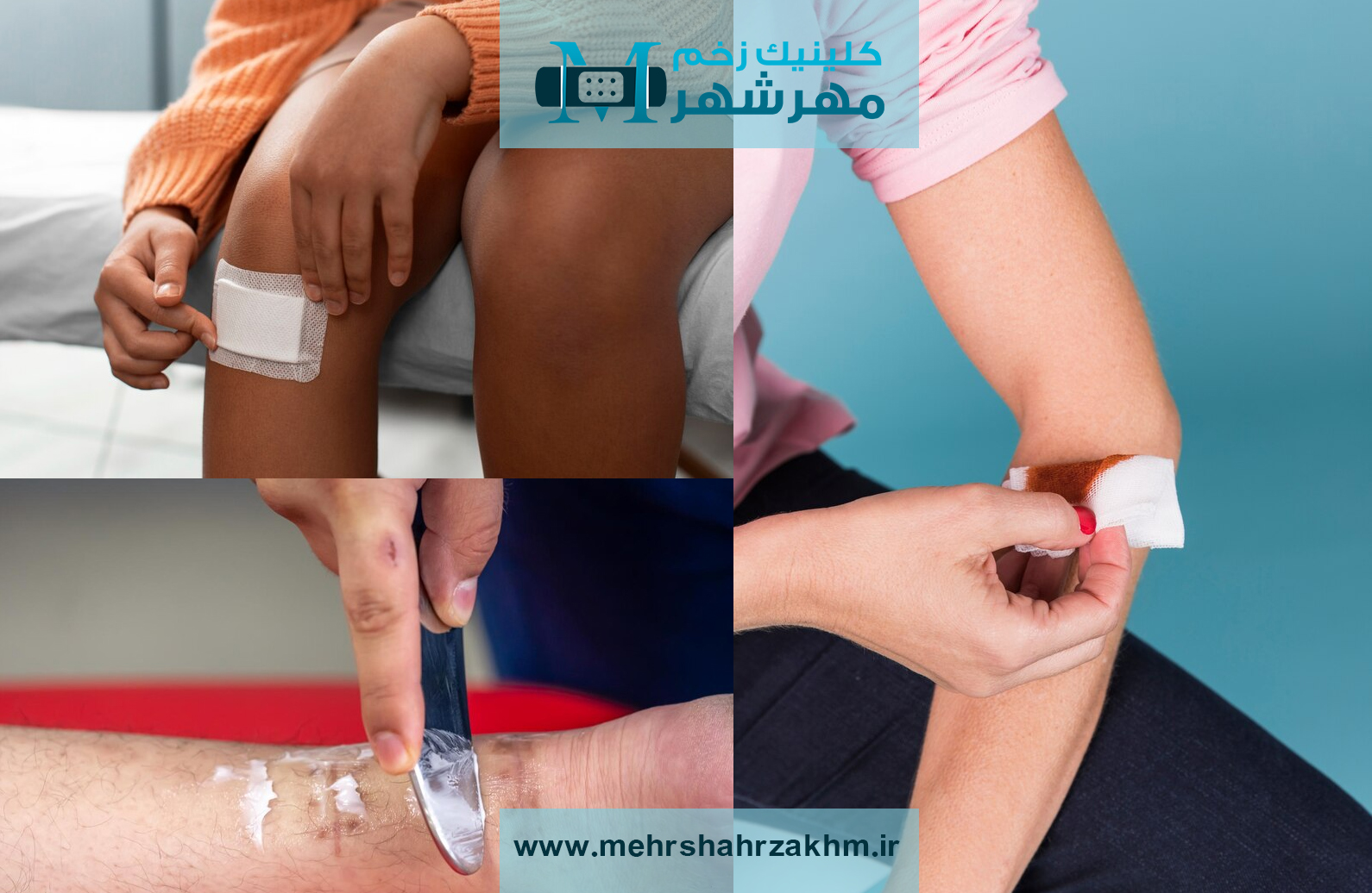 نحوه­ صحیح کندن پانسمان چسبیده به زخم بدون آسیب به بافت