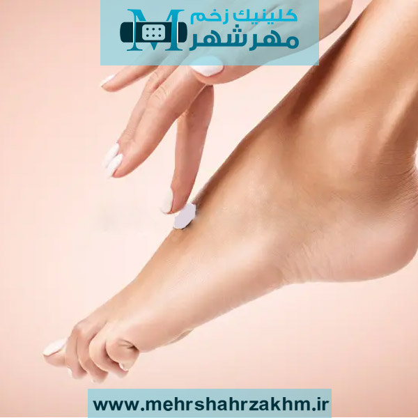 بهترین پماد برای زخم پای دیابتی