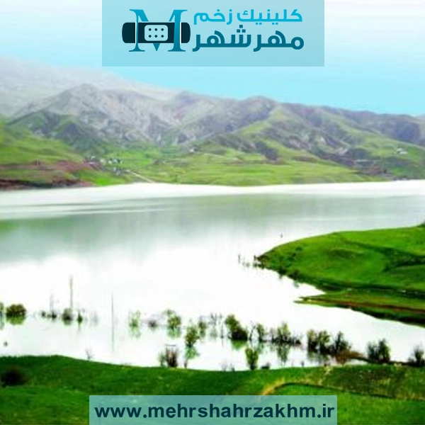 کلینیک درمان زخم حرفه‌ای در طالقان کجاست؟