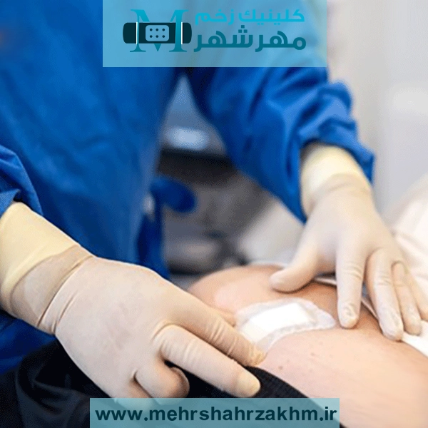 چطور باید کیست مویی را پانسمان کنیم؟