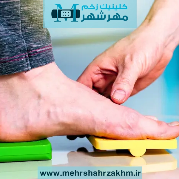 بهترین روش درمان کف پای صاف + تمرینات اصلاحی