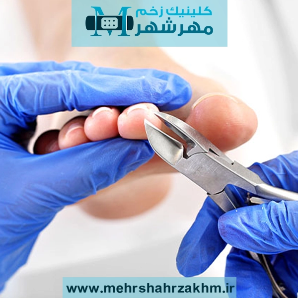 پودولوژی در کرج برای کودکان، سالمندان و ورزشکاران