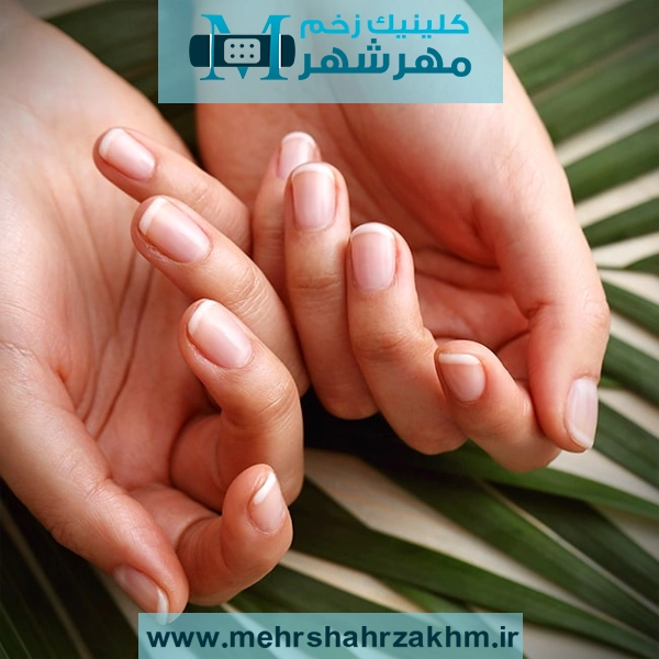 رشد نکردن ناخن دست و پا به چه علتی است؟