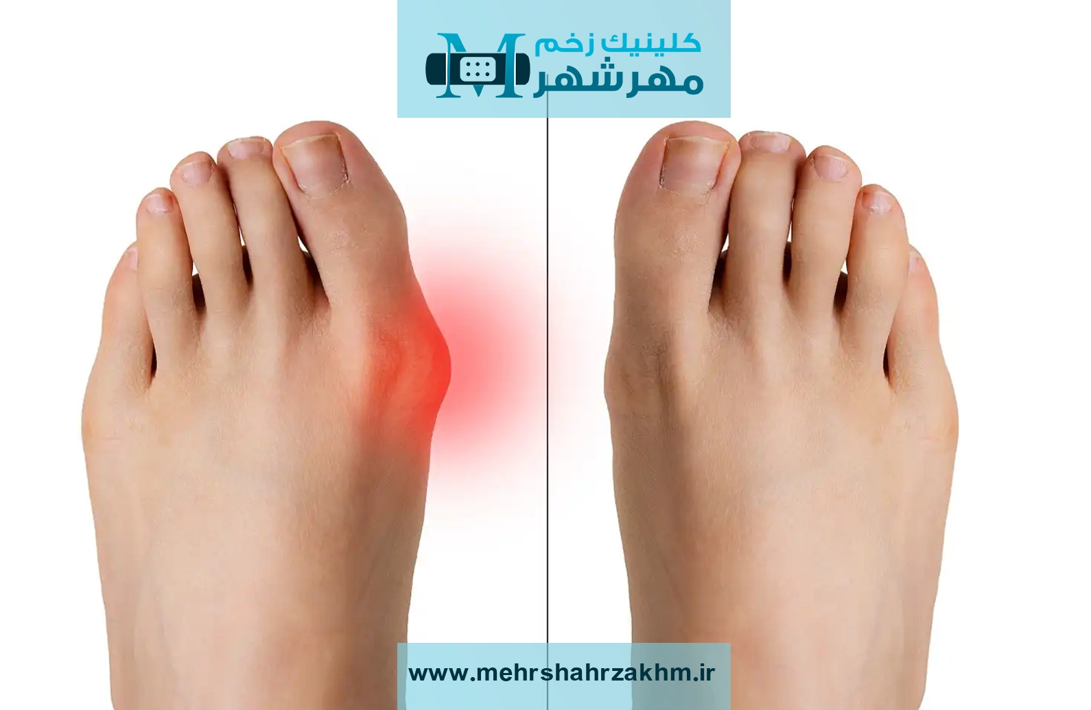 آیا انحراف شست پا خطرناک است؟